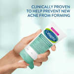 Cetaphil Gentle SA Moisturizer Salicylic Acid Acne Treatment 89ml Sri Lanka - Image 2